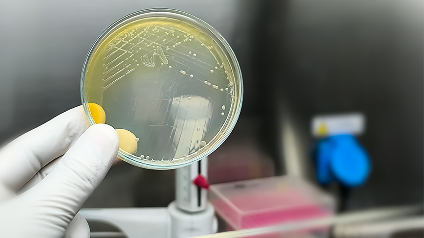 Gloved hand holding up petrie dish with bacteria growing in it