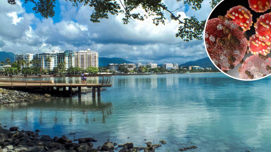 View of Cairns waterfront with inset of measles virus